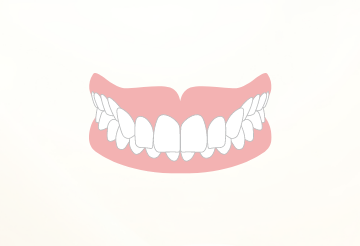 噛み合わせが深い