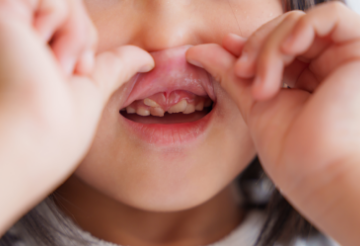 歯の本数が多い