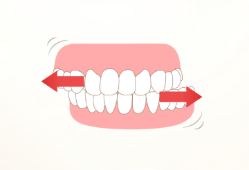 グラインディング