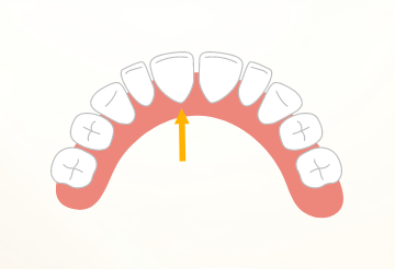 乳歯と歯ぐきの間